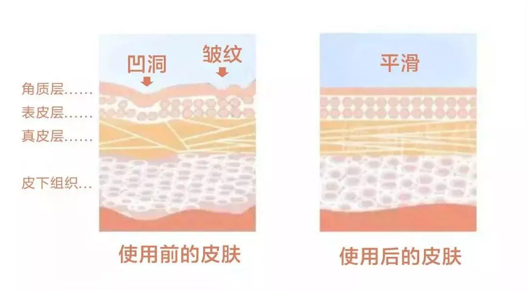 法令纹会让自己显老5到10岁,法令纹显老十岁教你解决