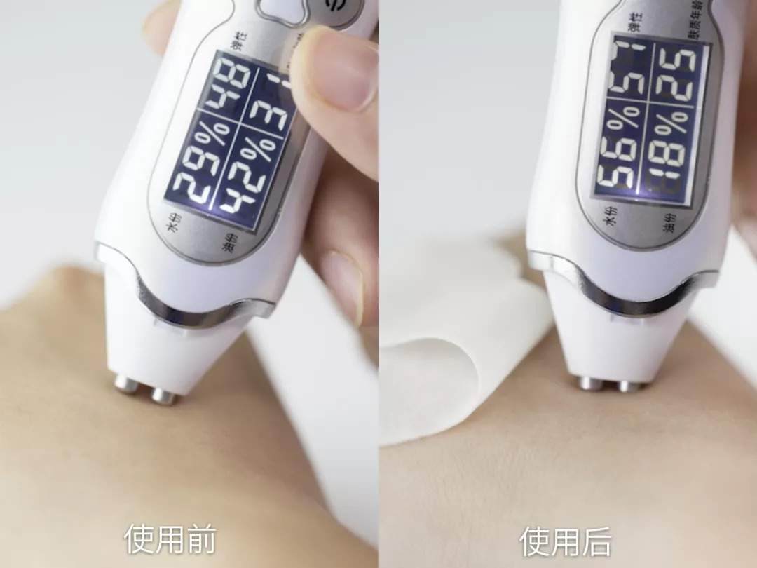 法令纹会让自己显老5到10岁,法令纹显老十岁教你解决