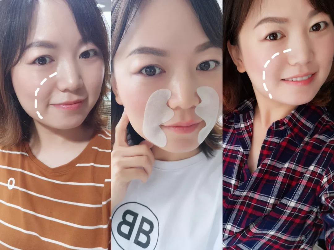 法令纹会让自己显老5到10岁,法令纹显老十岁教你解决