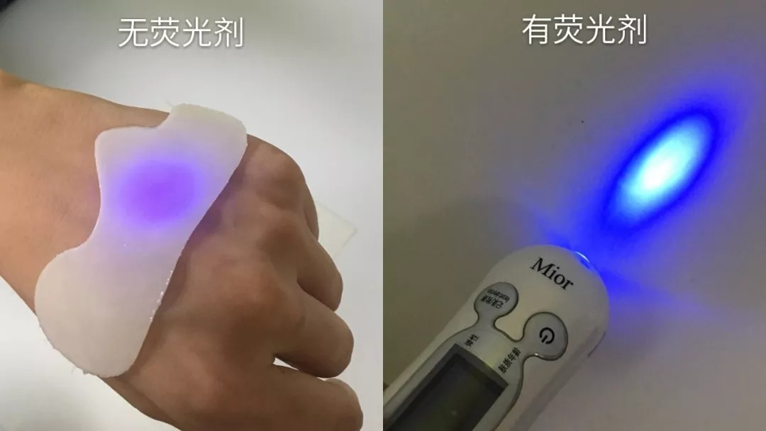 法令纹会让自己显老5到10岁,法令纹显老十岁教你解决