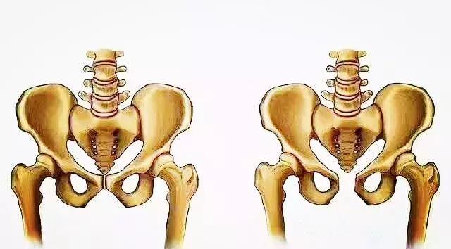 产后「绝望」的耻骨联合痛,妈妈秒懂