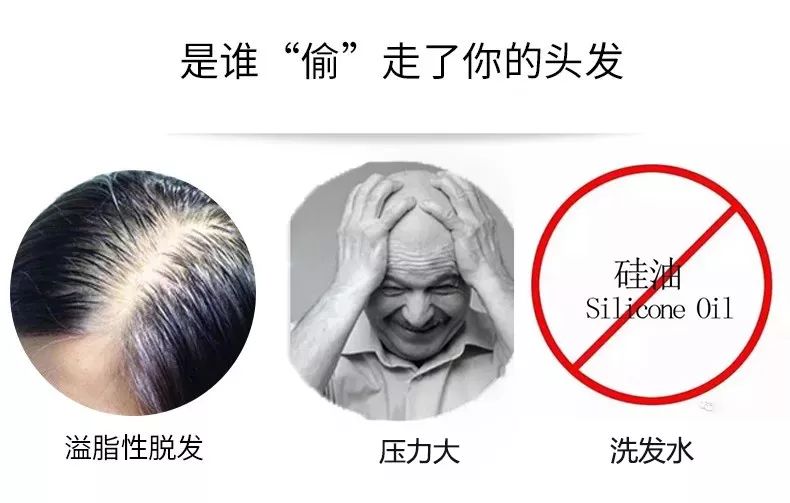 郭富城洗发水品牌,郭富城的头发用什么发蜡好