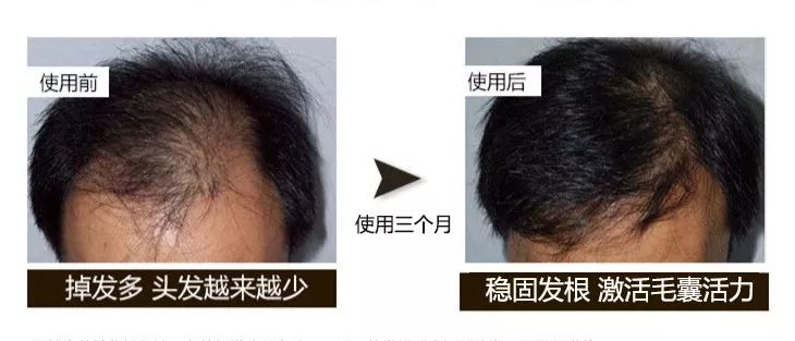 郭富城洗发水品牌,郭富城的头发用什么发蜡好