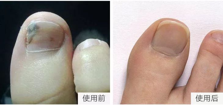 “男朋友的脚堪比生化*器武**！我得治治他！”