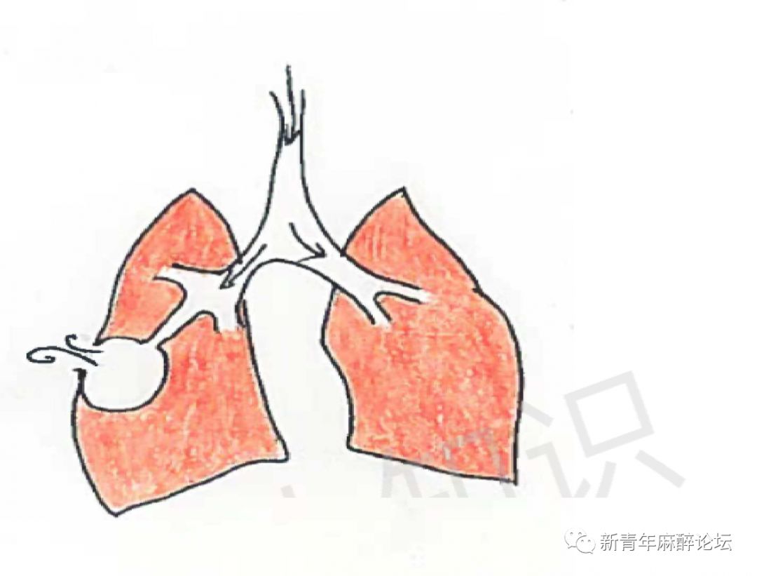 呼吸科普类视频制作,科普人体呼吸机制