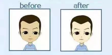 拍身份证照片为什么那么丑,身份证照片太丑怎么拍才正确