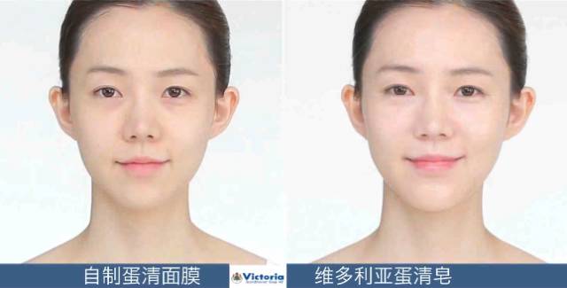 只听说蛋清能除皱,没想到瑞典皇室竟然用它来洗脸,还能去黑头!