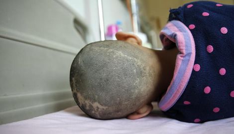 10岁男孩查出肾癌,10岁男孩身亡其生父发声