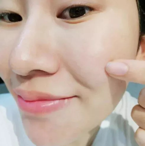 去黑头去角质慕斯,3分钟祛除黑头