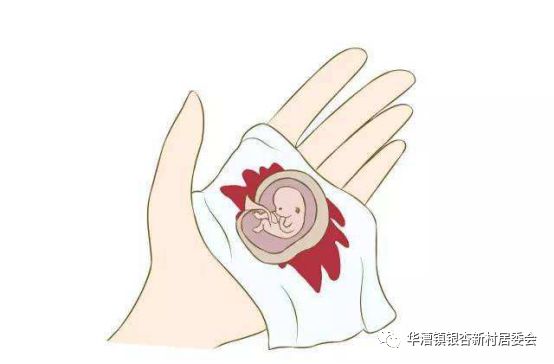 不同人流产,人工流产后几个月避孕