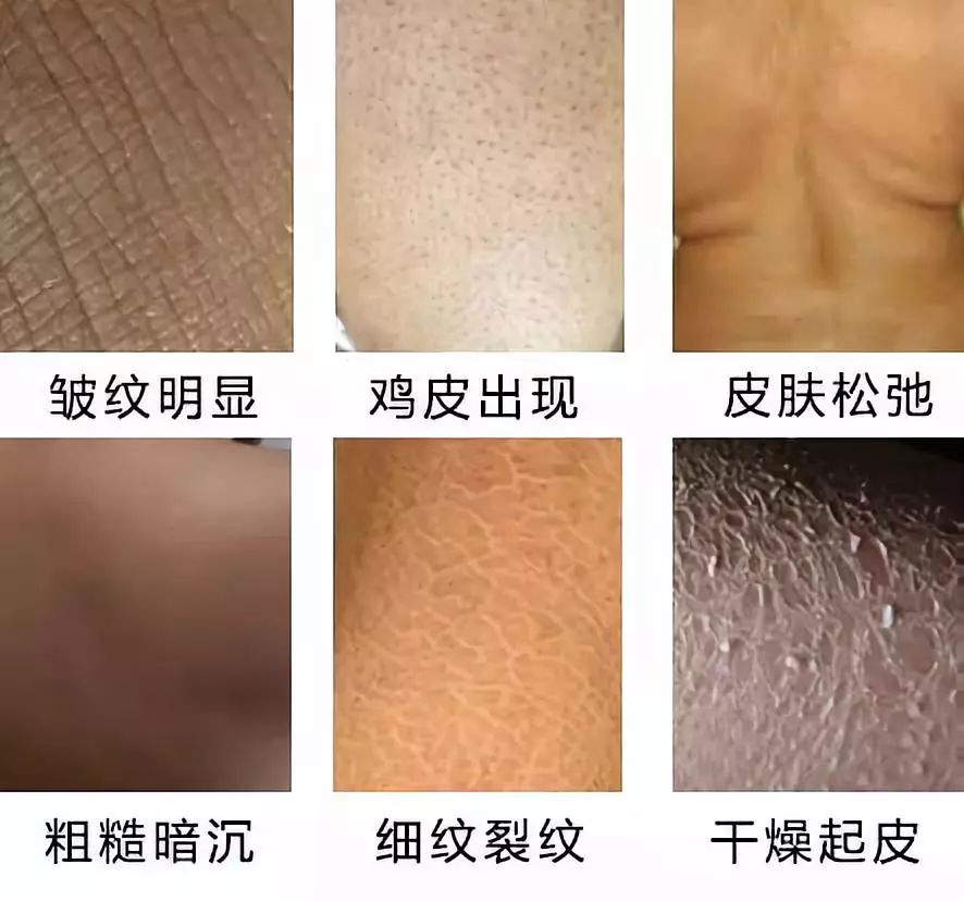 卖疯了!澳洲平价绵羊油,秋冬补水保湿首选,一罐用全身,英国女王都打call