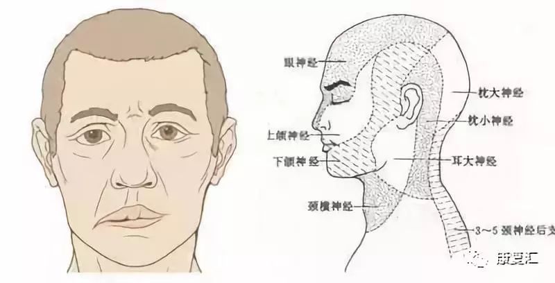 康复科治疗面瘫效果怎么样,面瘫康复训练评分