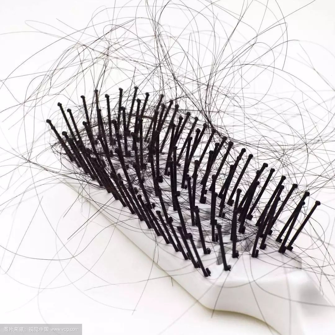 脱发的原因有哪些预防方法是什么,脱发的原因和治疗方法中医