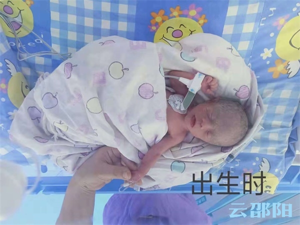 一产妇诞下“巨型”婴儿,19岁产妇产下婴儿