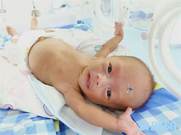 一产妇诞下“巨型”婴儿,19岁产妇产下婴儿