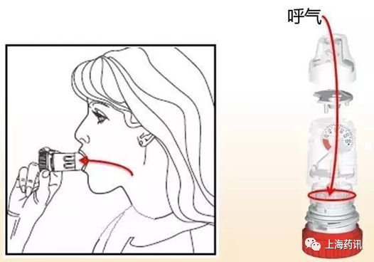 都保吸入剂为什么不能停,都保吸入剂正确使用方法
