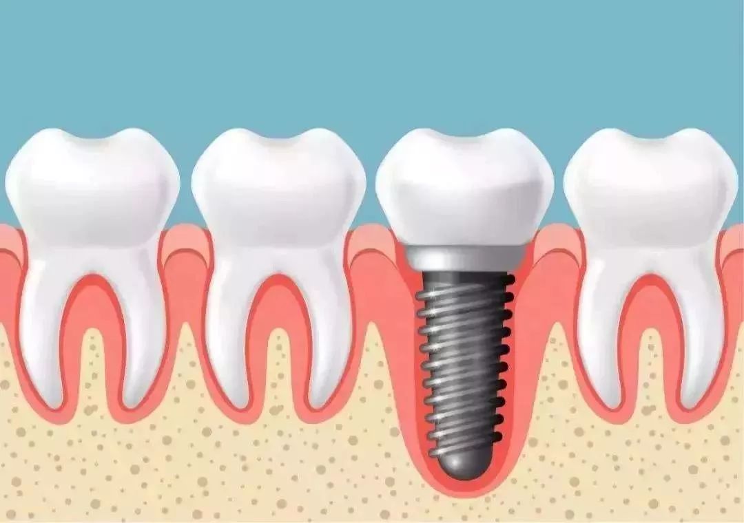 种植专家一对一亲诊报名热线0431-84817888