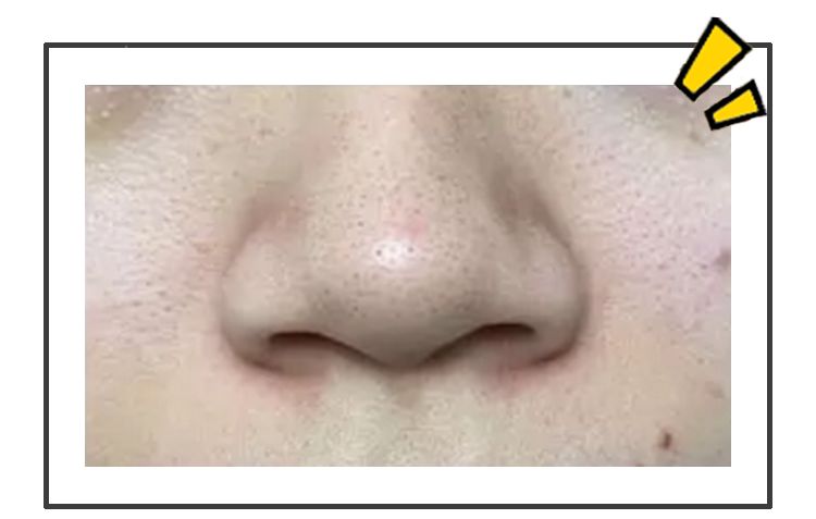 君君面膜套装,君君冻干粉面膜