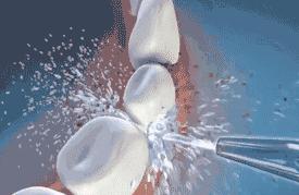 不到1折疯抢！全家口腔健康有保证~29.9元抢购原价895元劲松牙科家庭口腔护理套餐！超声波洁牙+中老年口腔护理+儿童口腔护理…