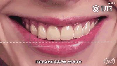 缺牙修复补贴政策,缺牙补牙补贴