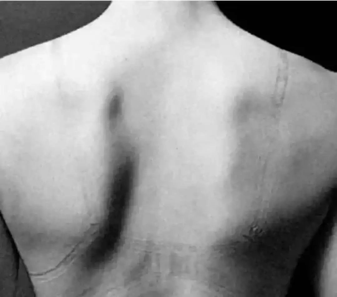 给自己穿最好的舒服健康的内衣,无钢圈内衣才是最健康的内衣