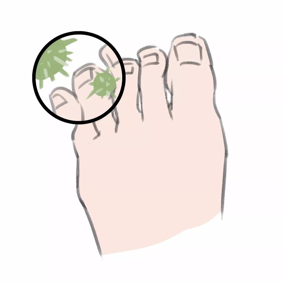 “医生，我下面有点痒……”