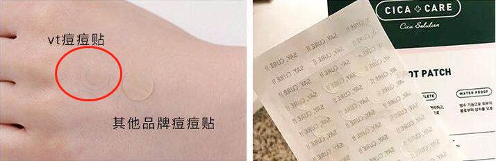 推荐的祛痘面膜青春期,祛痘紧急修复面膜