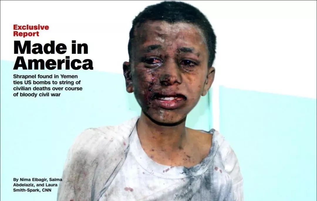 普利策奖饥饿的小孩,饥饿女孩