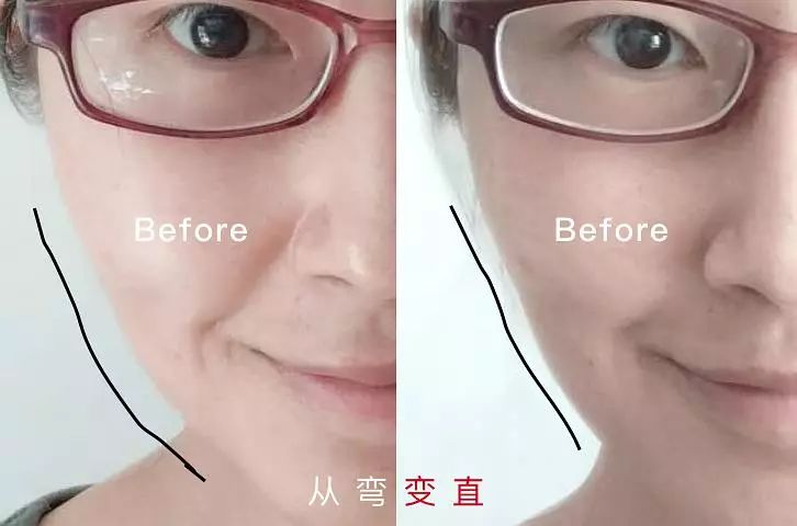 敏感肌哪一款美容仪是最好的,改善肤质选哪款美容仪