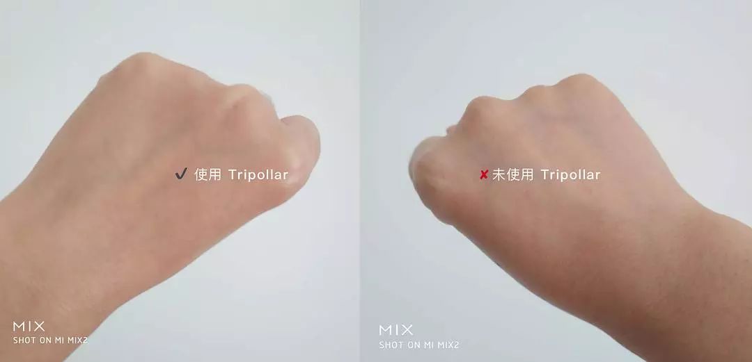 敏感肌哪一款美容仪是最好的,改善肤质选哪款美容仪