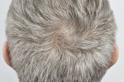 多情应笑我,早生华发-为80后白发干部支招