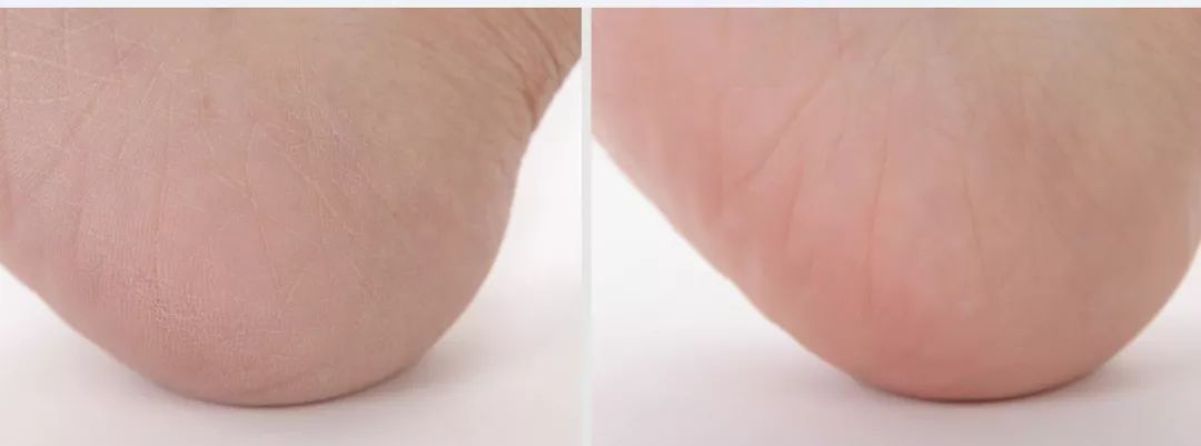 预告｜平价好用的澳洲绵羊油面霜，滋润不油腻，吸收好，擦完皮肤光滑柔软，还能用来卸妆，护发，软化脚部死皮，一瓶多用，实在！