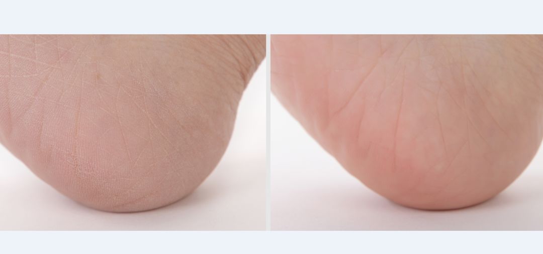 预告｜平价好用的澳洲绵羊油面霜，滋润不油腻，吸收好，擦完皮肤光滑柔软，还能用来卸妆，护发，软化脚部死皮，一瓶多用，实在！