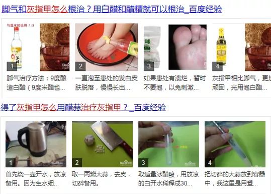 灰指甲的治愈之路你值得拥有,10年顽固灰指甲久治不愈