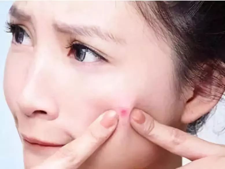 鐥樼棙鍗冧竾涓嶈涔辨尋鐔繃鍘诲氨濂戒簡,鐥樼棙鍗冧竾涓嶈闅忎究鍘绘尋