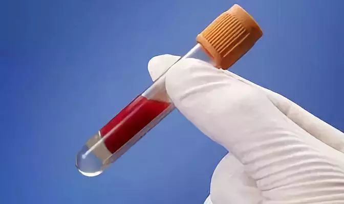 高脂血症的最新用药,高脂血症用药一览表