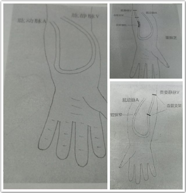“三线支撑”患者高满意度航空总医院肾内科探秘究竟