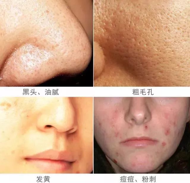 人脸上螨虫的数量,人脸上有多少螨虫