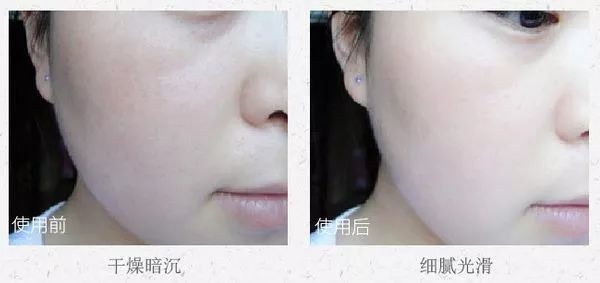 人脸上螨虫的数量,人脸上有多少螨虫