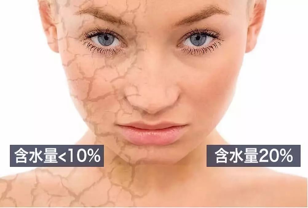 肌肤水润滋养秋冬干燥,肌肤水润嫩滑保湿护肤品