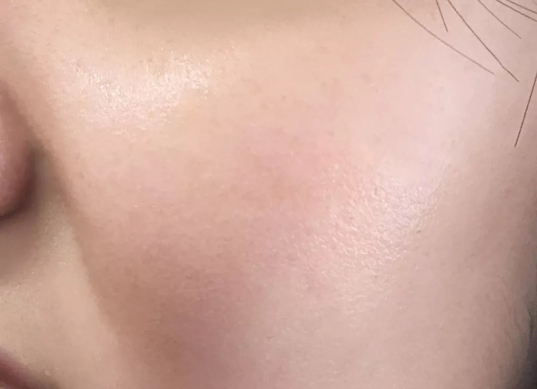 肌肤水润滋养秋冬干燥,肌肤水润嫩滑保湿护肤品