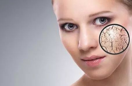 皮肤换季干燥如何护肤,换季怎么护肤才可以不缺水