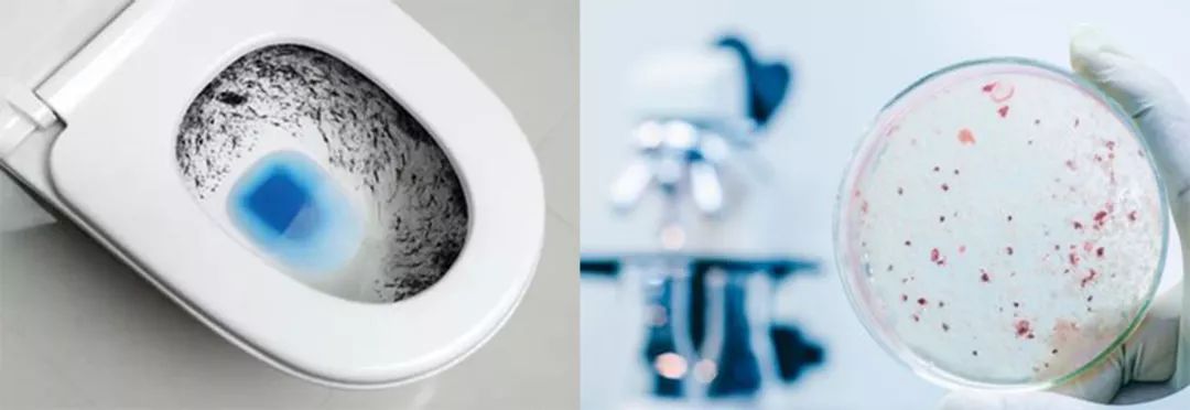 马桶下水管道一直有异味怎么解决,马桶里的脏东西洗不下来怎么办