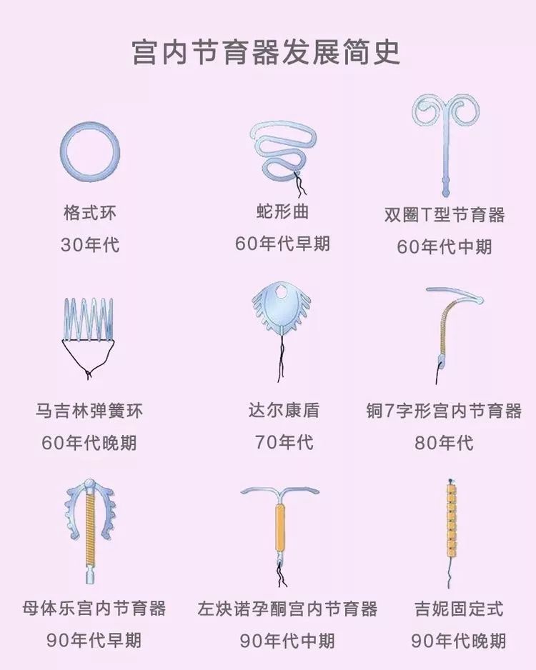 宫内节育器y型,渭北宫内节育器