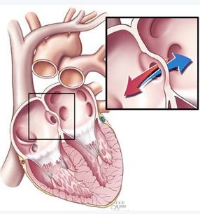 熬夜加饮食不规律导致胃出血,熬夜饮食不规律便血