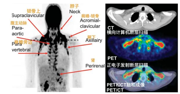 不穿秋裤腿毛会变多吗,不穿秋裤腿变粗冷知识