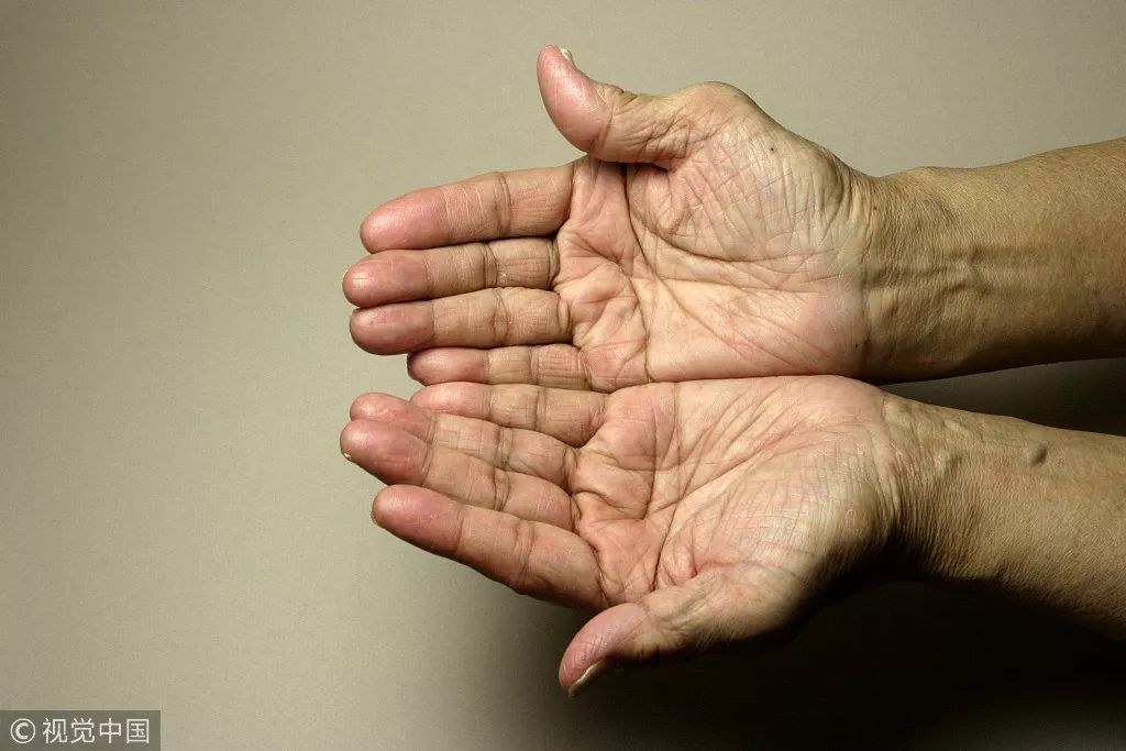 妈妈*证办**时发现指纹消失！知道原因后心里酸酸的……