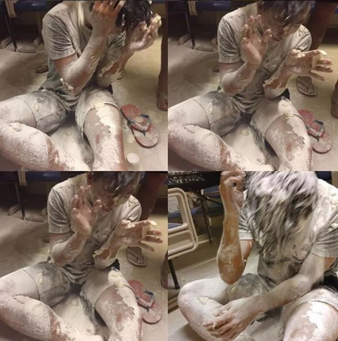 过生日被烫伤意味着什么,大学生吃火锅被烧伤