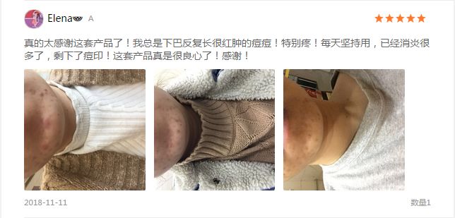 这支研自985药学教授的祛痘神器，刷爆了大学朋友圈