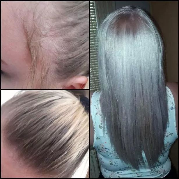 防脱而且还生发的洗发水,一款可以从根本改善发质的洗发水